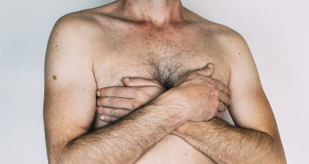 Top 10 Myths Busted: The Truth Behind Gynecomastia